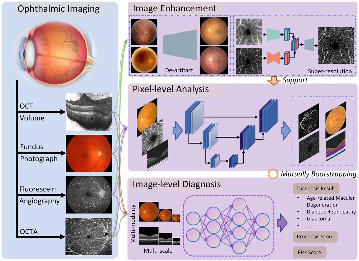 AI for Ophthalmology